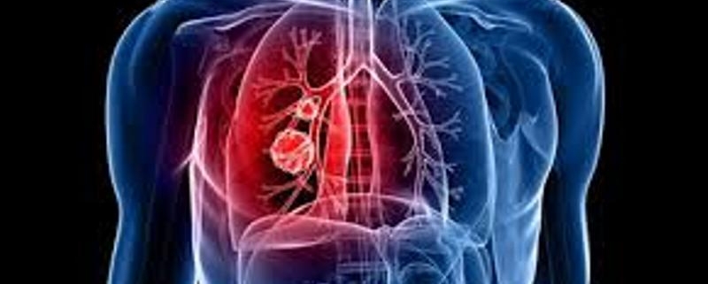 خدمات ویژه آمبولانس خصوصی سفیر حیات | انتقال ایمن بیماران اورژانسی و مراقبت‌های ویژه در تهران، کرج و سراسر ایران با تجهیزات مدرن