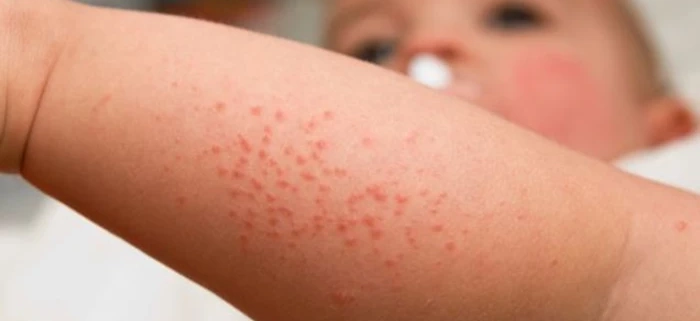 خدمات ویژه آمبولانس خصوصی سفیر حیات | انتقال ایمن بیماران اورژانسی و مراقبت‌های ویژه در تهران، کرج و سراسر ایران با تجهیزات مدرن