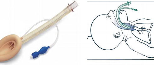 خدمات ویژه آمبولانس خصوصی سفیر حیات | انتقال ایمن بیماران اورژانسی و مراقبتهای ویژه در تهران، کرج و سراسر ایران با تجهیزات مدرن