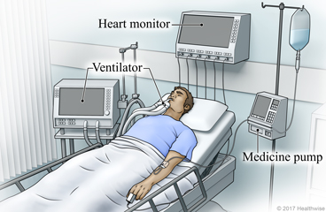 تجهیزات بیماران icu