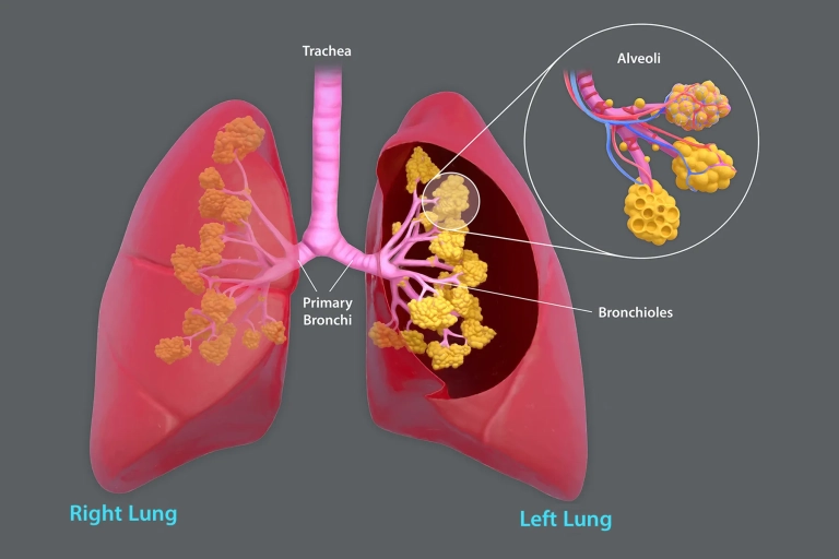 انسداد مزمن ریه COPD و مراقبت ایمن بیماران تنفسی