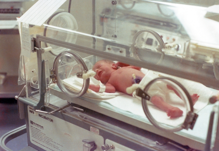 انتقال نوزادان NICU