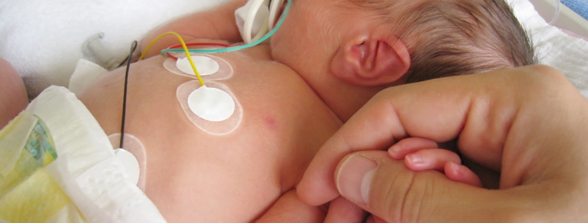 انتقال نوزادان NICU
